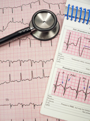 EKG and stethoscope