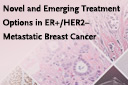 Novel and Emerging Treatment Options in ER+/HER2− Metastatic Breast Cancer